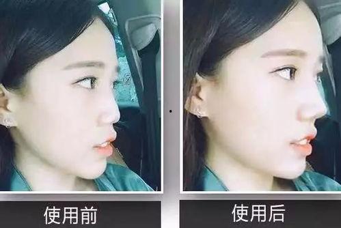 鼻子操视频,鼻子操视频教程，告别鼻塞烦恼